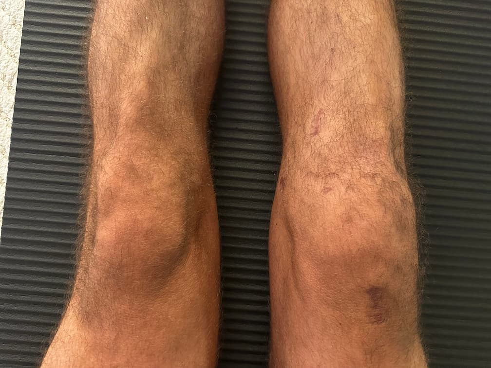 Progress Photo Day 100