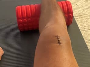 Progress Photo Day X