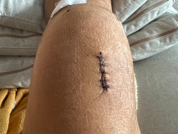 Progress Photo Day X