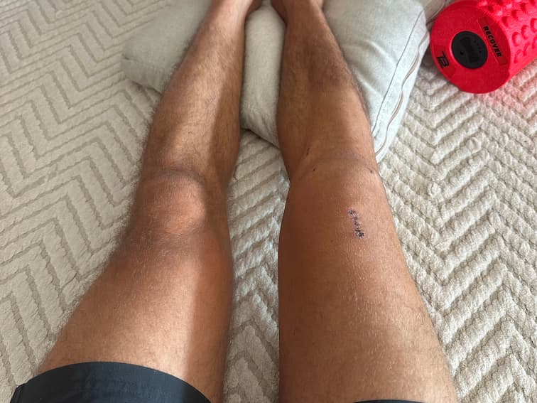 Progress Photo Day X