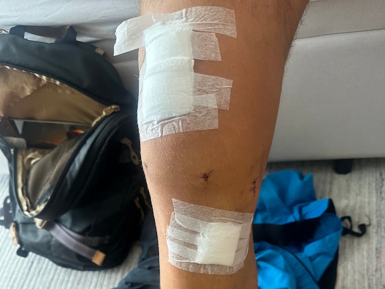 Progress Photo Day X