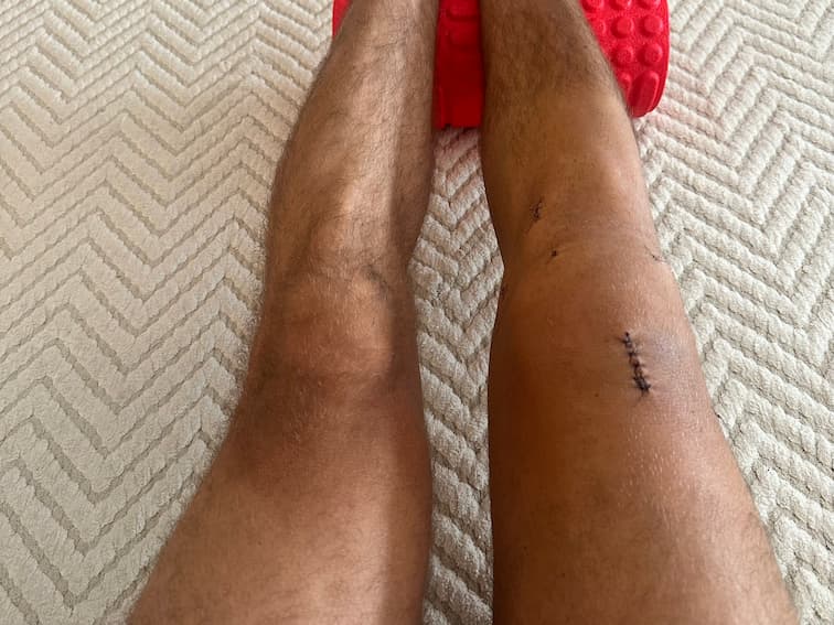 Progress Photo Day X