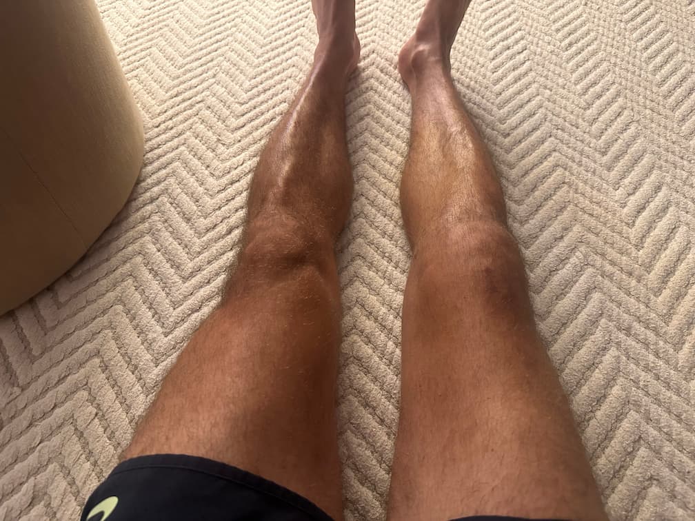 Progress Photo Day 75