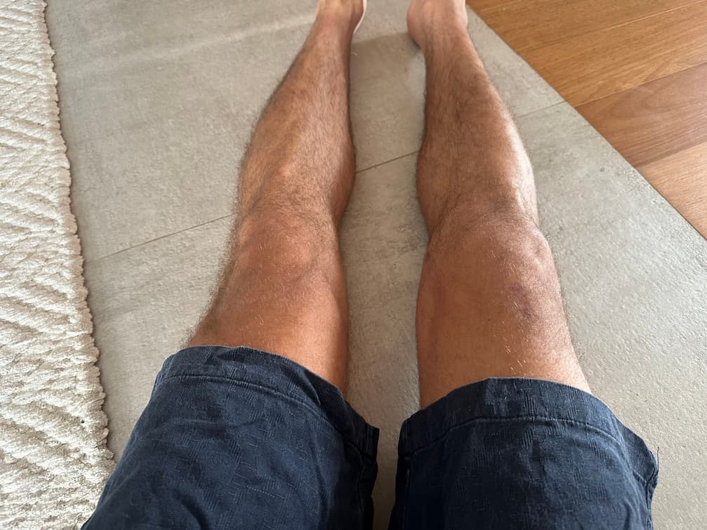 Progress Photo Day 77