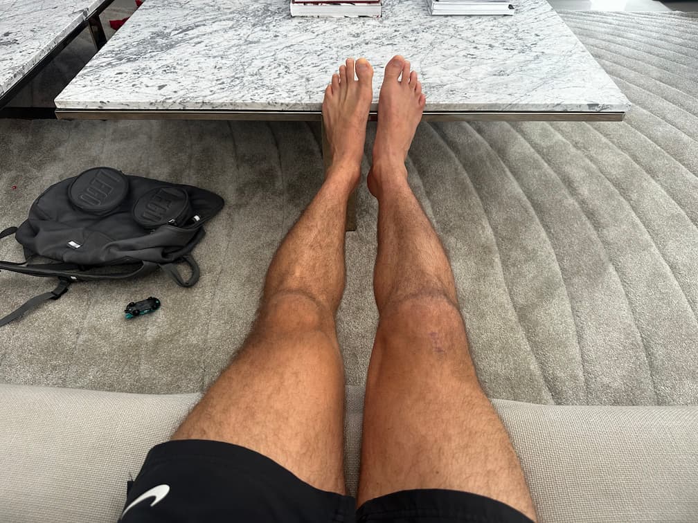 Progress Photo Day 83