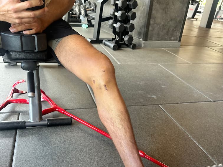 Progress Photo Day X